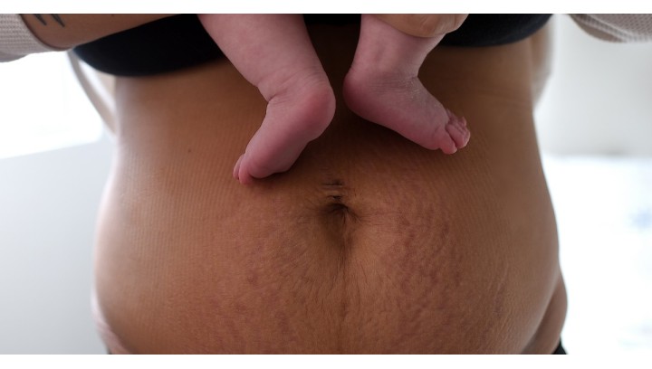 Pasy brzuszne po porodzie: wsparcie dla świeżo upieczonych mam